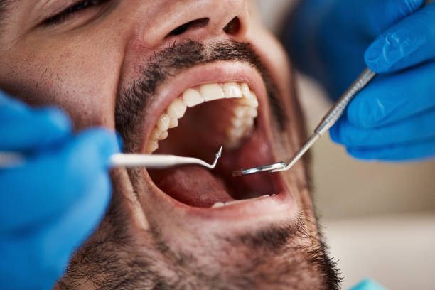 Best Broken or Cracked Tooth Emergency Dentist in Hardeeville, SC