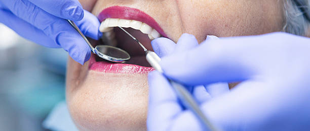 Best Emergency Dental Care for Abscessed Tooth in Hardeeville, SC